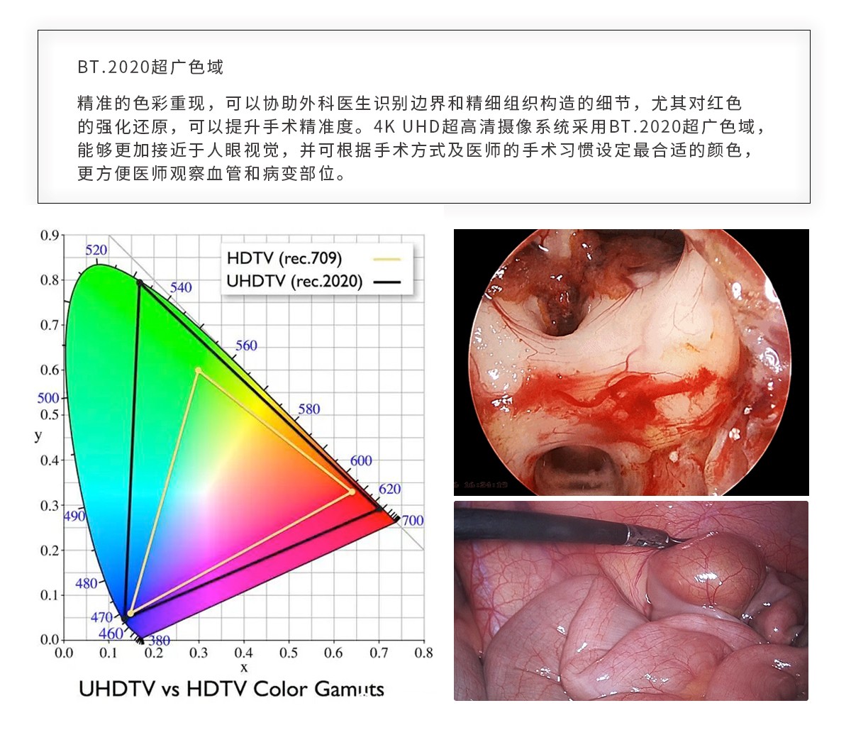 【4K醫用內窺鏡攝像系統】您的第一臺“4K”找到了嗎？