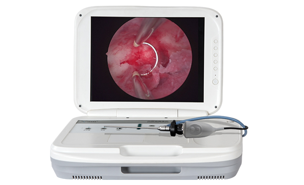 醫(yī)用內窺鏡攝像系統一體機安裝