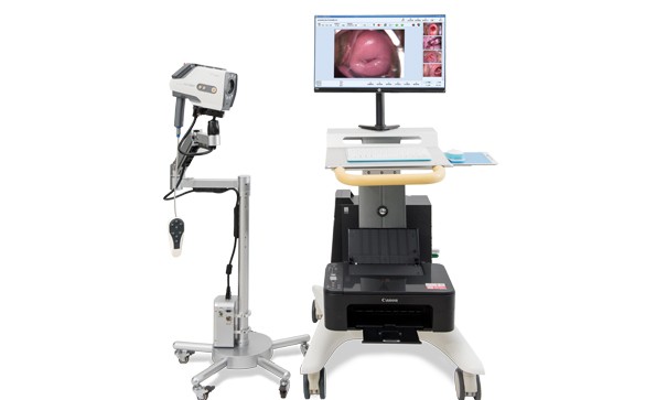 數碼電子陰道鏡與TCT技術診斷早期宮頸癌